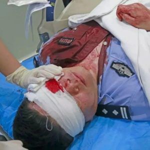 致敬！被鲜血染红的警号：005234，愿战友早日康复